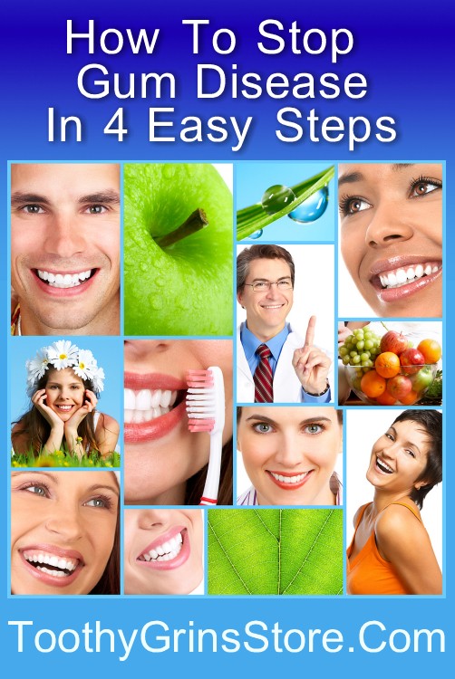 How To Stop Gum Disease In 4 Easy Steps - Free Guide Available